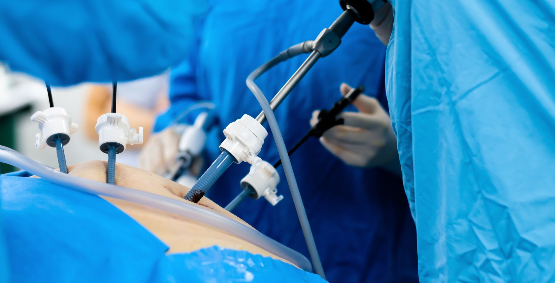 Laparoscopic Surgeries at Sri Bindu Hospital, Kadapa - Minimally invasive surgery for quick recovery